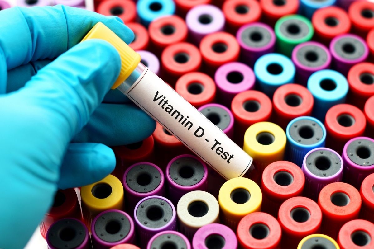 How Doctors Read a Vitamin D Blood Test